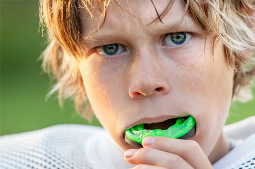 The Importance Of Athletic Mouthguards [VIDEO]