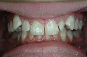 Q-before-orthodontics